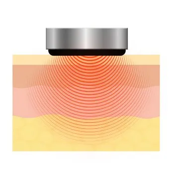 4DトロイダルRF図解